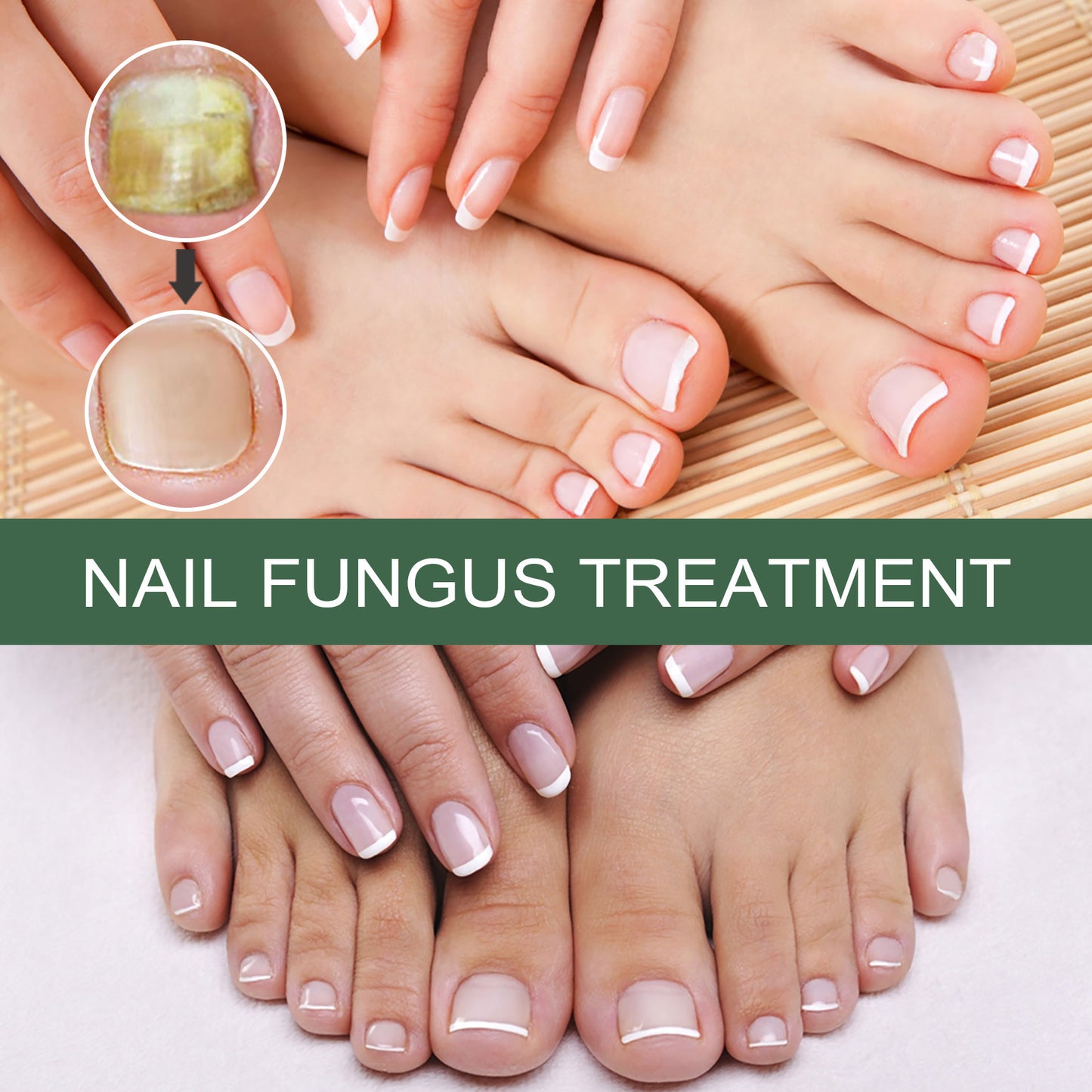 eelhoe onychomycosis repair liquid thickening and polishing soft nail liquid foot care liquid onychomycosis nail care liquid