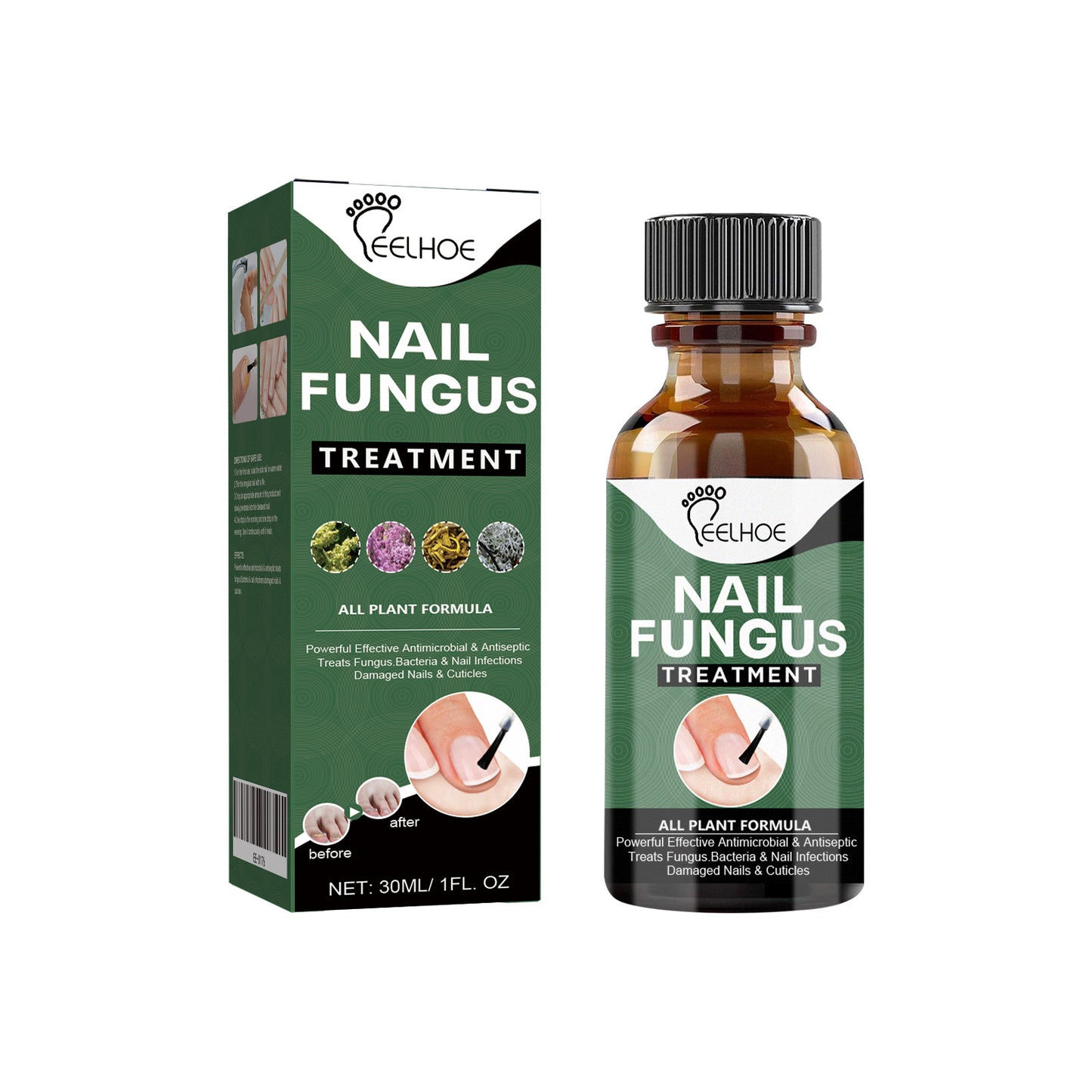 eelhoe onychomycosis repair liquid thickening and polishing soft nail liquid foot care liquid onychomycosis nail care liquid