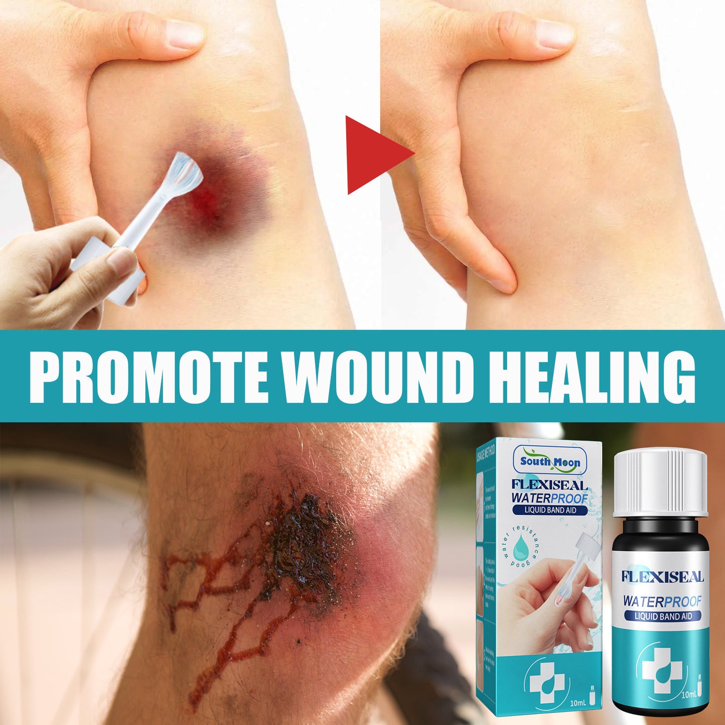 South Moon waterproof liquid bandage wound surface protection fast film transparent liquid bandage