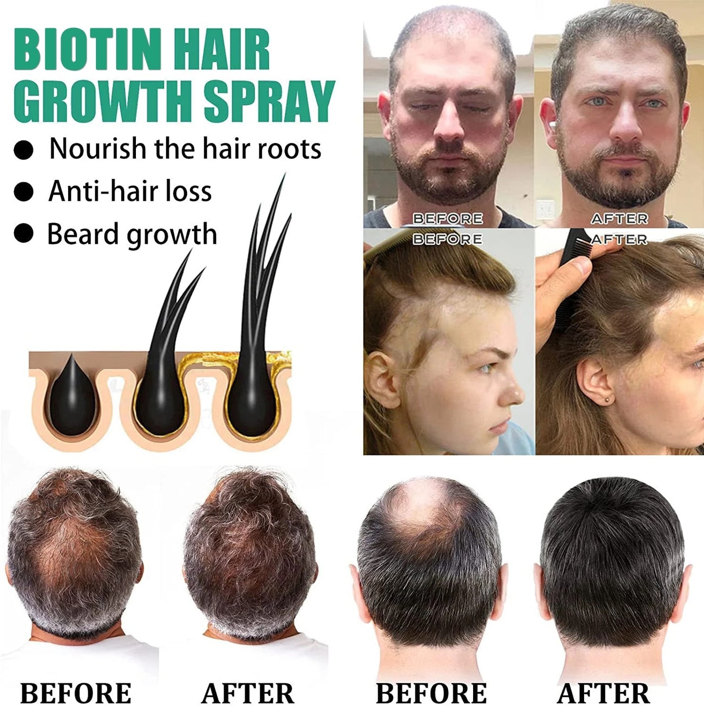 iBraLee anti-hair loss hair growth liquid solid hair increase hair care hair dense hair liquid essence manufacturers wholesale