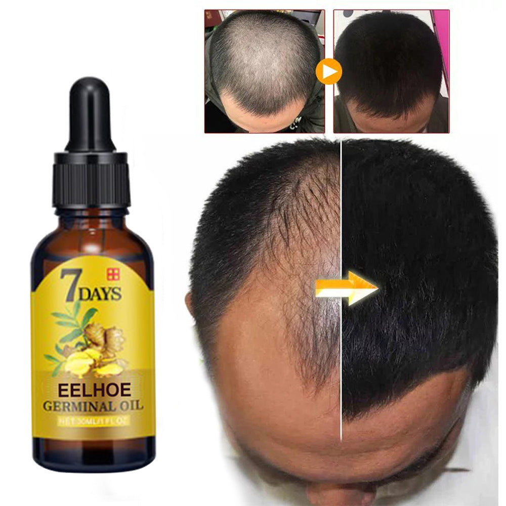 EELHOE Ginger Hair Growth Liquid Hair Care Improvement Hair Care Moisturizing Anti-hair Loss Nutrient Liquid