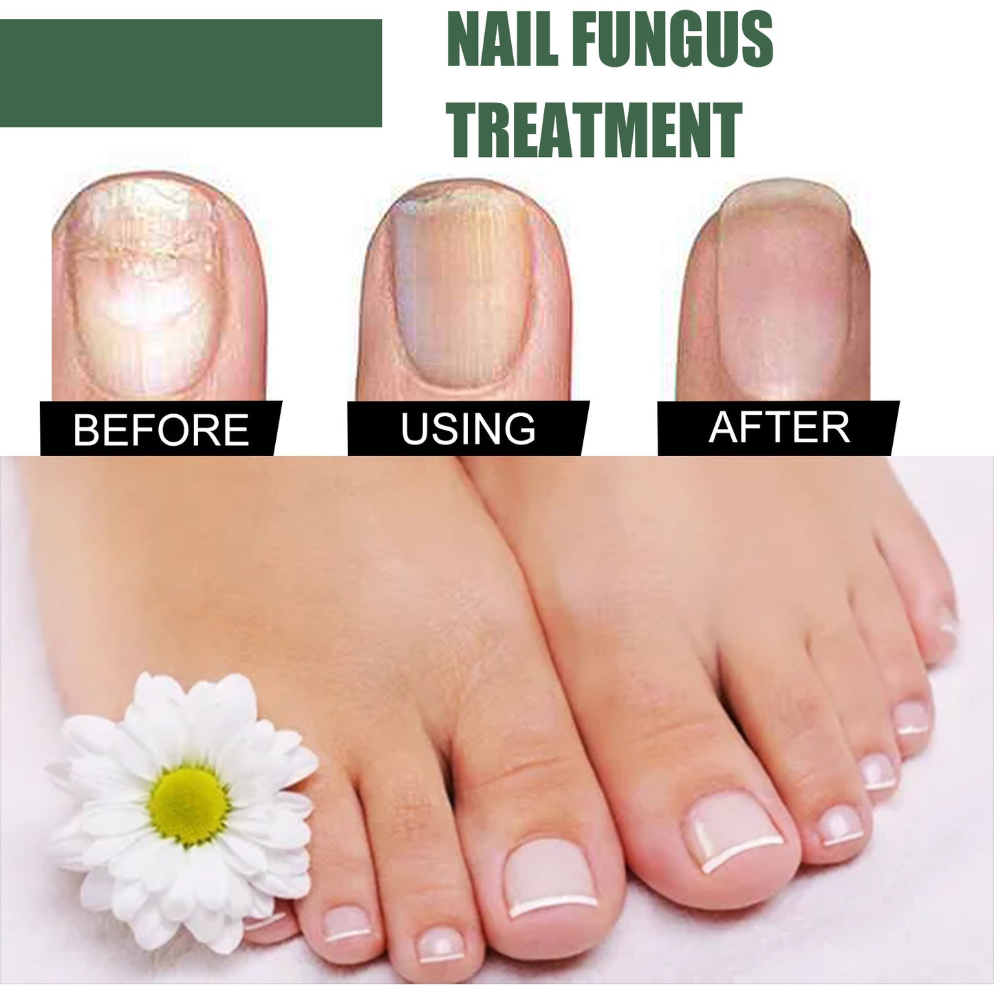 eelhoe onychomycosis repair liquid thickening and polishing soft nail liquid foot care liquid onychomycosis nail care liquid